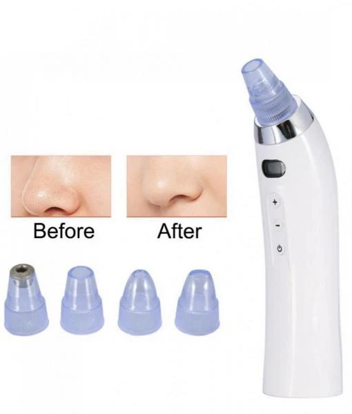 Вакуумный аппарат для чистки лица и пор