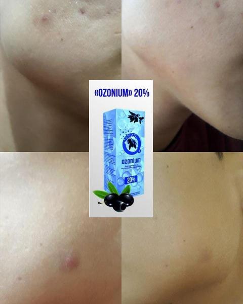 Maslo "Ozonium" – 20%.