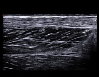 Esaote MyLab X75 universal ultratovush skaneri