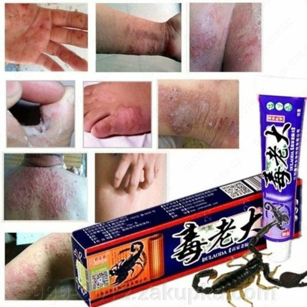 Мазь с ядом скорпиона от кожных заболеваний