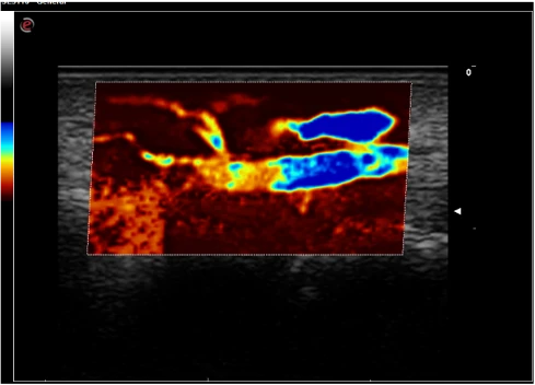 Esaote MyLab Omega ekspert sinfining portativ ultratovush tizimi