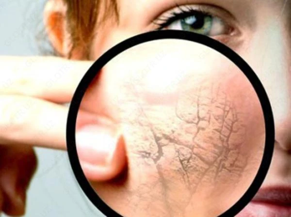 Средство от выпадения волос "Мinoxidil kirkland 5%"