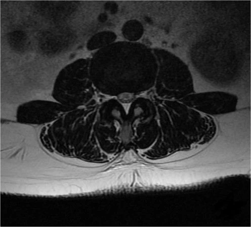 Магнитно-резонансная томография (МРТ) NSM-S15 1.5T