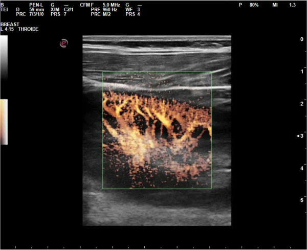 Универсальный портативный ультразвуковой сканер Esaote MyLab Sigma