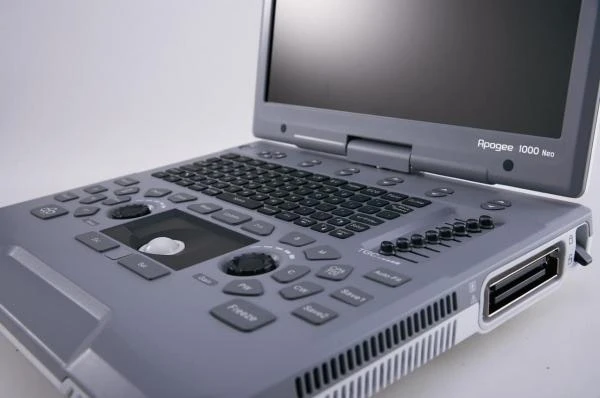 Portativnaya svetnaya ultrazvukovaya diagnosticheskaya sistema APOGEE 1000
