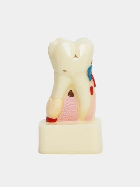 Муляж Pathology model