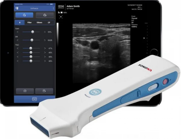 Портативный УЗИ аппарат SONON 300l
