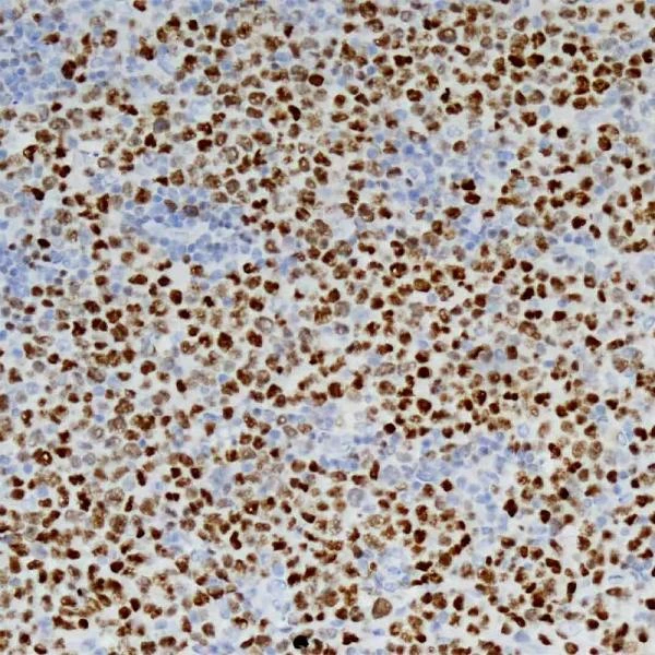 TRINOKULYAR MIKROSKOP Raqamli kamera va LCD monitorli BS-2046T