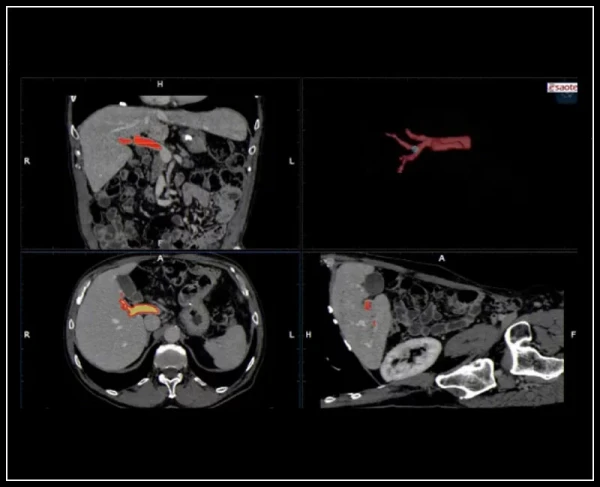 Ультразвуковой томограф нового поколения Esaote MyLab 9 eXp