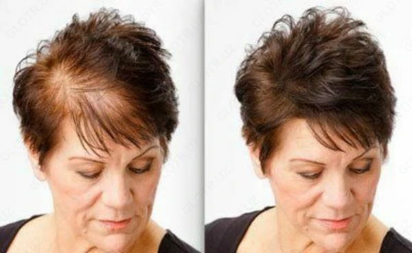 Laringoskop tipa Makintosh 4 klinka