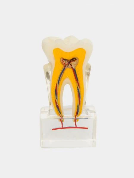 Mulyaj 6X tooth model with nerve