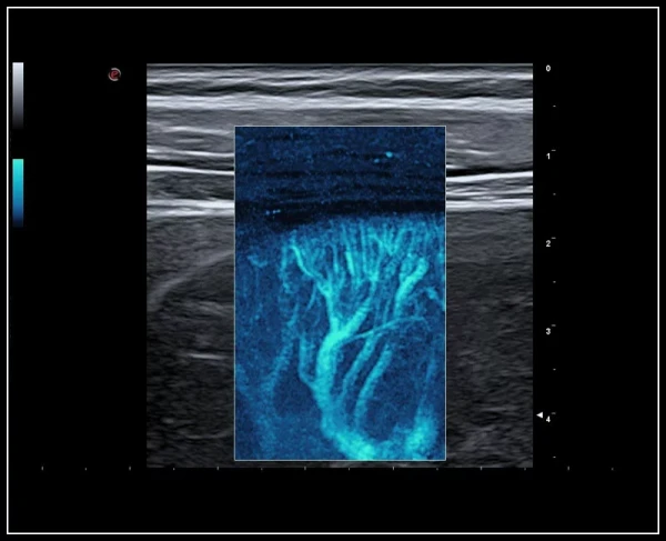 Ko'p funktsiyali ultratovushli tomograf Esaote MyLab 9 eXp