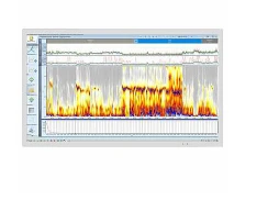 Xolterovskaya sistema Medilog Darwin Professional