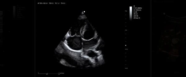 Ultrazvukovaya diagnosticheskaya oborudovanie ViV80