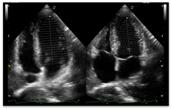 УЗИ аппарат Esaote MyLab X6