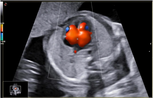 УЗИ аппарат экспертного класса Esaote MyLab X6