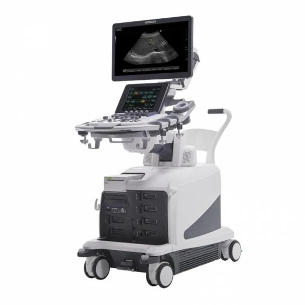 УЗИ аппарат Aloka Arietta 850