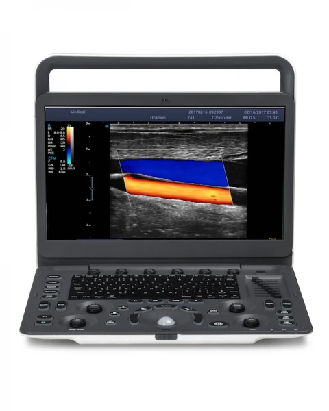 Система ультразвуковой диагностики Модель: SonoScape E3