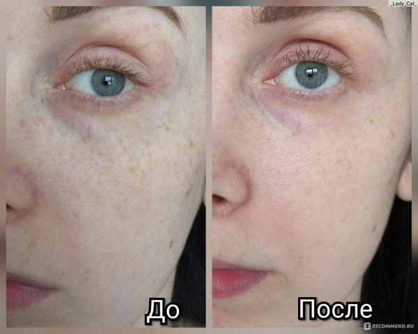 Крем отбеливающий Achroactive Max