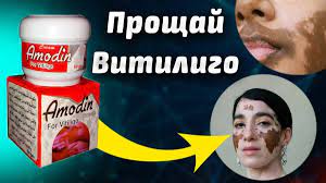 Krem Amodin [Amodin] dlya lecheniya vitiligo ot Harraz