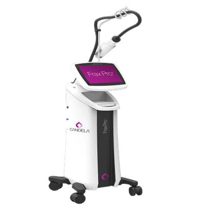 Lazernaya sistema FraxPro