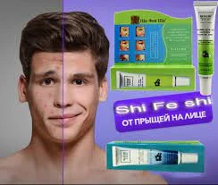 Krem Xi fei shi protiv prishey