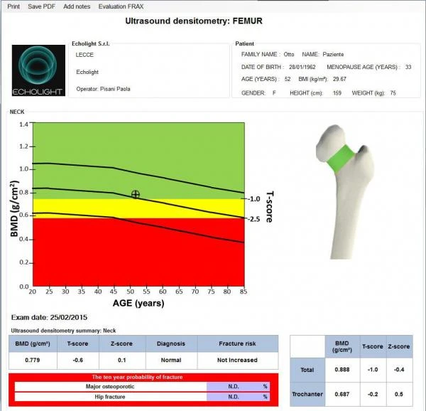 EchoStation portativ suyak densitometri