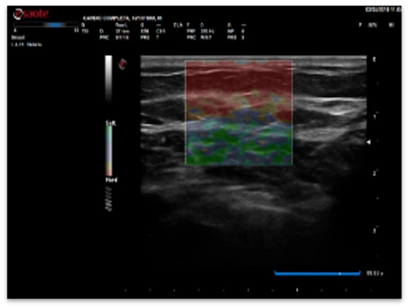 УЗИ аппарат экспертного класса Esaote MyLab X6