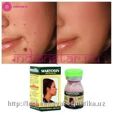 Gel ot papillom Wartosin