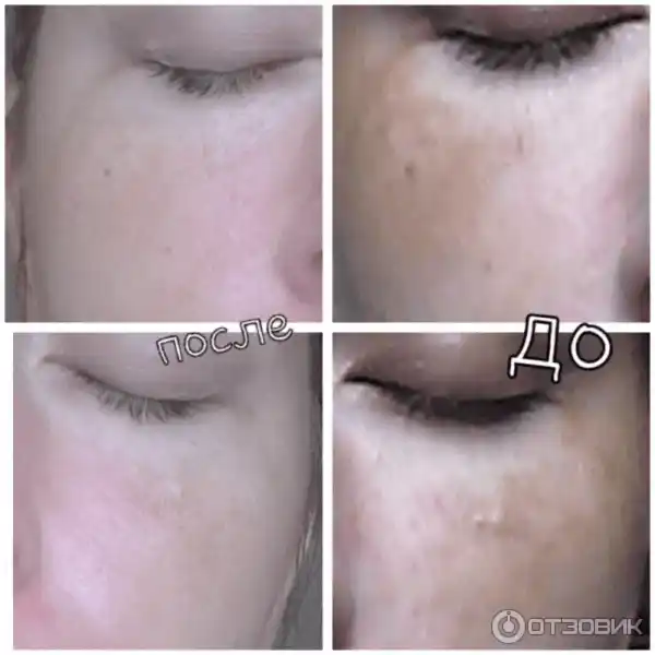 Крем отбеливающий Achroactive Max