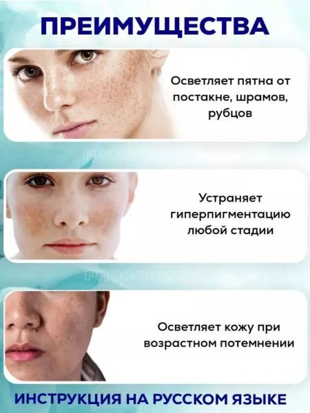 Осветляющий крем при нарушении пигментации кожи Expigment 4% (30 грамм)