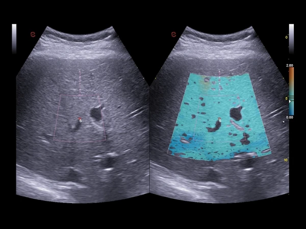 Ko'p funktsiyali ultratovushli tomograf Esaote MyLab 9 eXp