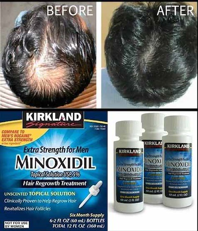 Minoksidil kirkland - 5% (original) Original 100%