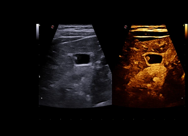 Ultrazvukovoy tomograf ESAOTE MyLab X90