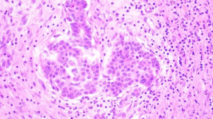 TRINOKULYAR MIKROSKOP Raqamli kamera va LCD monitorli BS-2046T