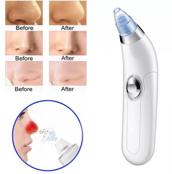 Derma Suction yuz teringizni toza qiladigan vosita