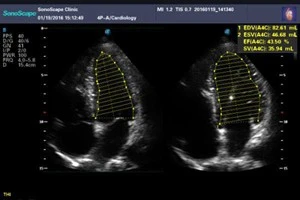 Sistema ultrazvukovaya diagnostika Model: SonoScape P-9