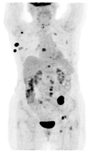Система ОФЭКТ-КТ-ПЭТ Mediso AnyScan