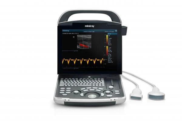 Портативная ультразвуковая диагностическая система MINDRAY DP-30
