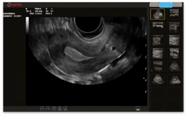 Esaote MyLab X5 ultratovush apparati