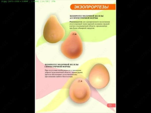 Ekzoprotez molochnoy jelezi