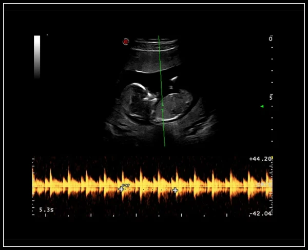 Ультразвуковой томограф нового поколения Esaote MyLab 9 eXp