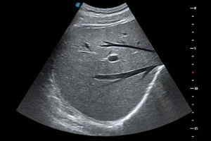 Sistema ultrazvukovaya diagnostika Model: SonoScape P-9