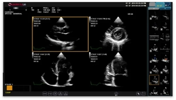 УЗИ аппарат экспертного класса Esaote MyLab X6