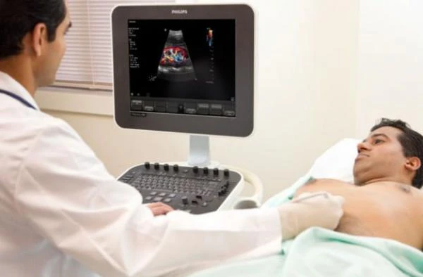 Ultrazvukovaya sistema Philips ClearVue 350