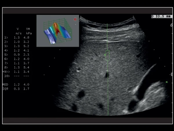 MyLab X8 eXP professional ko'p funktsiyali premium ultratovush skaneri.
