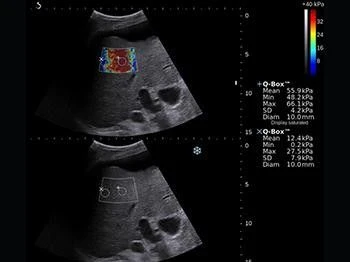 Sistema ultrazvukovoy diagnostiki model: SonoScape S 30