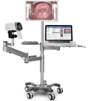 Videokolposkop modeli C6A HD