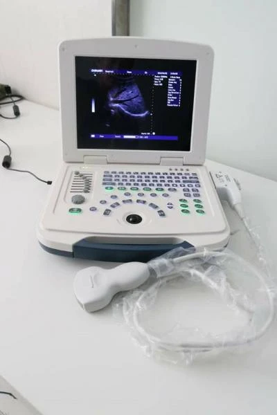 Ультразвуковой аппарат ноутбук