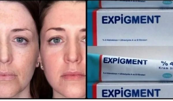 Осветляющий крем при нарушении пигментации кожи Expigment 4% (30 грамм)